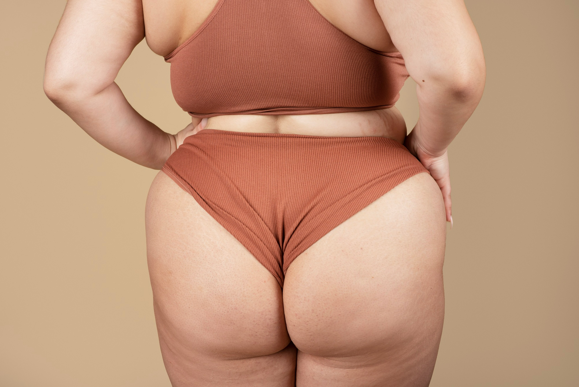 Zašto nastaje celulit i kako ga se riješiti prirodno – Larisa otkriva rješenje